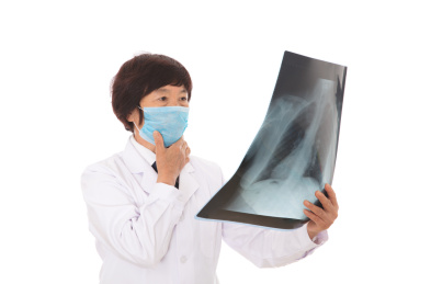 戴着口罩的女大夫仔细查看肺部X光片