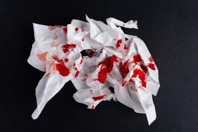 餐巾纸带血的图片图片