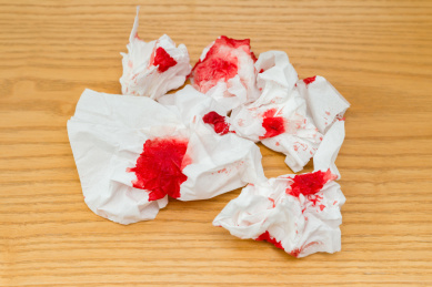纸巾带血图片
