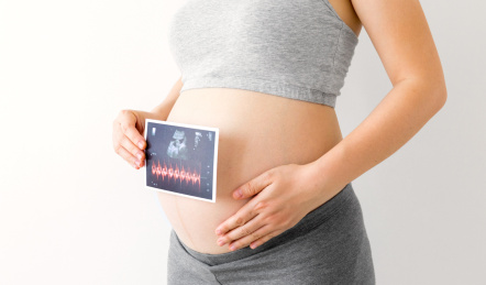 一位年轻孕妇手拿着一张胎儿B超照