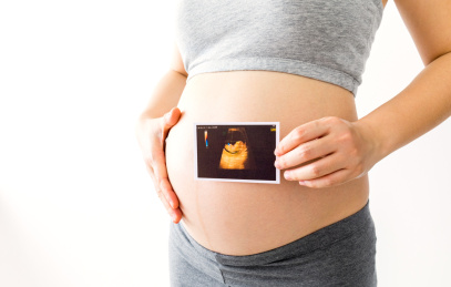一位年轻孕妇手拿着一张胎儿B超照