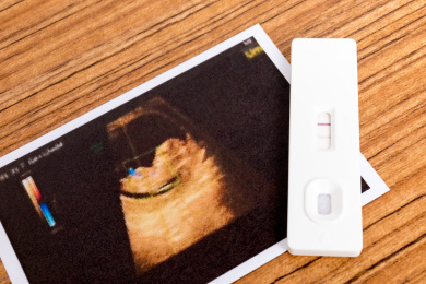 桌面上的一根验孕棒和一张胎儿B超照