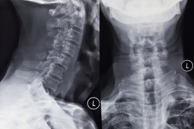 放射科X线摄影骨胳影像胶片