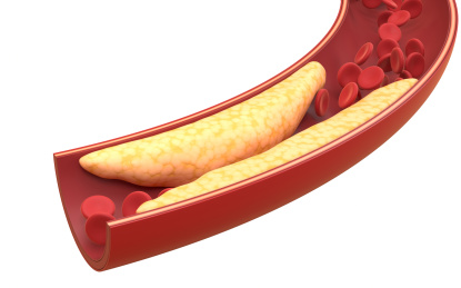 血管中的脂肪与红细胞 3D渲染