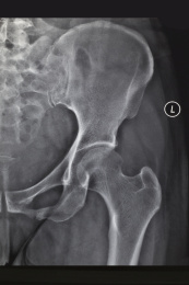 医院里的医学影像科内的放射DR胶片图像
