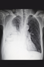 医院里的医学影像科内的放射DR胶片图像