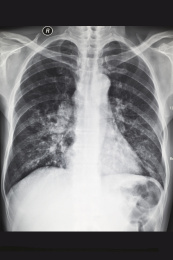 医院里的医学影像科内的放射DR胶片图像