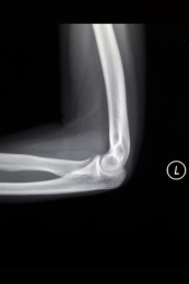 医院里的医学影像科内的放射DR胶片图像