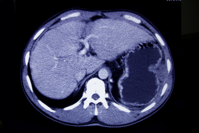 医院里的CT影像