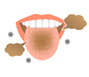 舌头口臭和牙齒