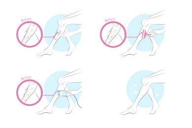 少女除腿毛插图