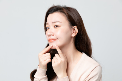 年轻女生下巴长痘痘