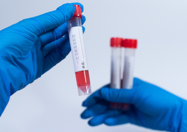 一次性病毒采集管病毒抗原试剂