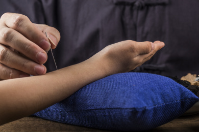 一位中医给病人做针灸