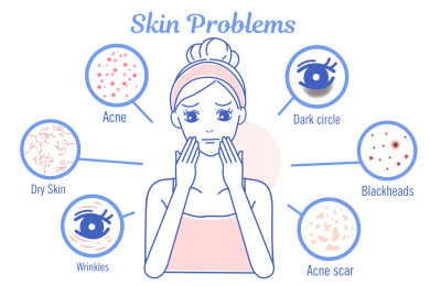 手绘风女人肌肤问题概念插图
