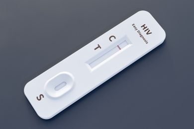 胶体金法HIV抗体检测试纸