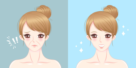 摆脱法令纹的女人 对照插图
