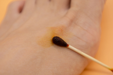 医疗用品清洗伤口碘伏和棉签