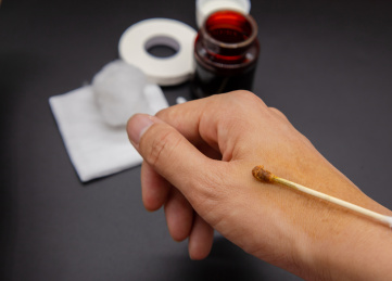 医疗用品清洗伤口碘伏和棉签