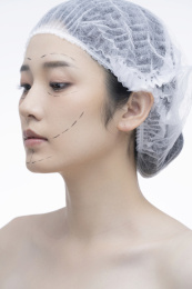 准备做面部提升的年轻女人