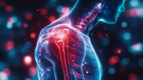 肩部疼痛的医学影像