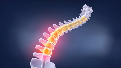 人体脊椎脊柱炎症概念