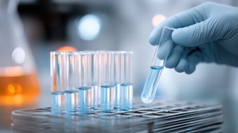 实验室人员操作试管