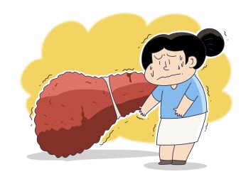肝硬化脂肪肝病人