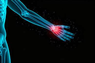 人体骨骼手部关节疼痛医学影像