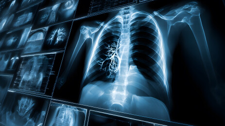 医学影像技术展示