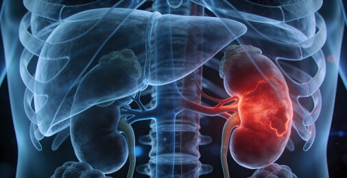 肾脏血管病变图