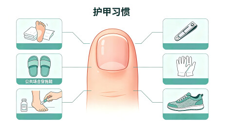 灰指甲日常护甲习惯科普插画图表