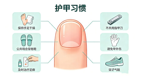 指甲护甲好习惯预防甲病科普信息图