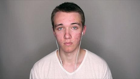 caucasian man feeling tired touching face_站酷海洛_正版图片_视频