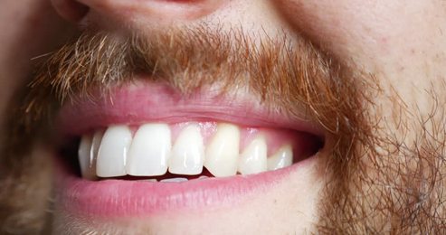 slowmotioncloseupprettyyoungwomanwithwhiteteethsmiling